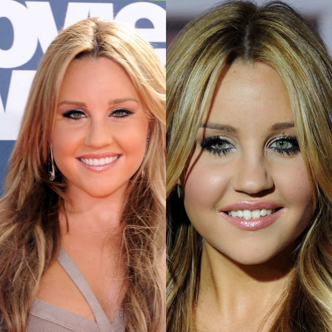 Amanda Bynes From Teen Icon to Cautionary Tale